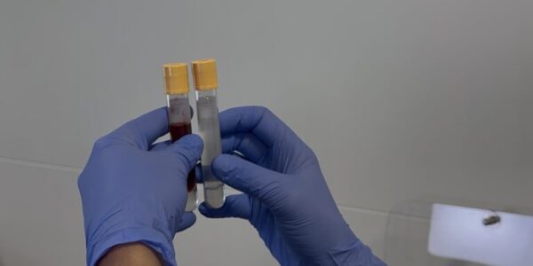 How to Become a Pathology Collector