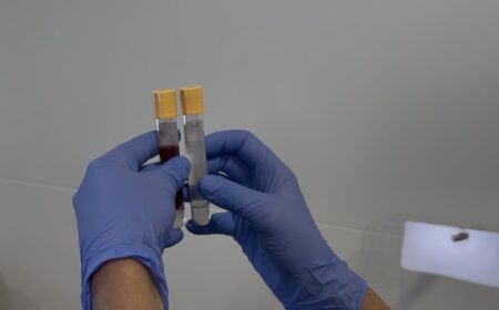 How to Become a Pathology Collector